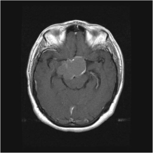 Aufnahmen Neurochirurgie | Sankt Gertrauden-Krankenhaus Berlin