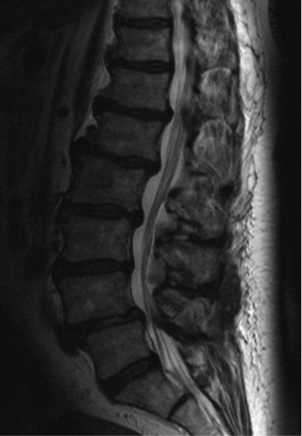 Aufnahmen Neurochirurgie | Sankt Gertrauden-Krankenhaus Berlin