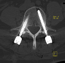 Aufnahmen Neurochirurgie | Sankt Gertrauden-Krankenhaus Berlin