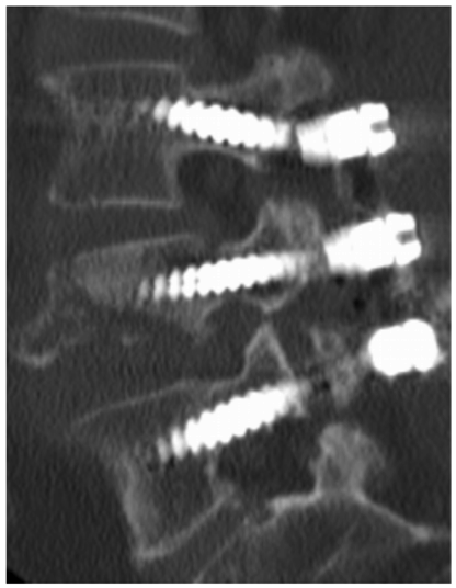 Aufnahmen Neurochirurgie | Sankt Gertrauden-Krankenhaus Berlin