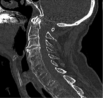 Aufnahmen Neurochirurgie | Sankt Gertrauden-Krankenhaus Berlin