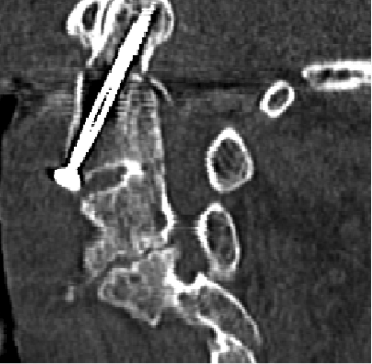 Aufnahmen Neurochirurgie | Sankt Gertrauden-Krankenhaus Berlin