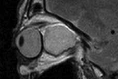 Aufnahmen Neurochirurgie | Sankt Gertrauden-Krankenhaus Berlin